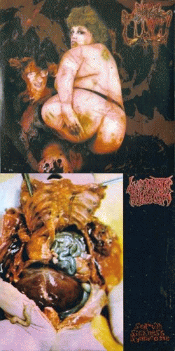 Lymphatic Phlegm : Untitled - Serum Sickness Syndrome